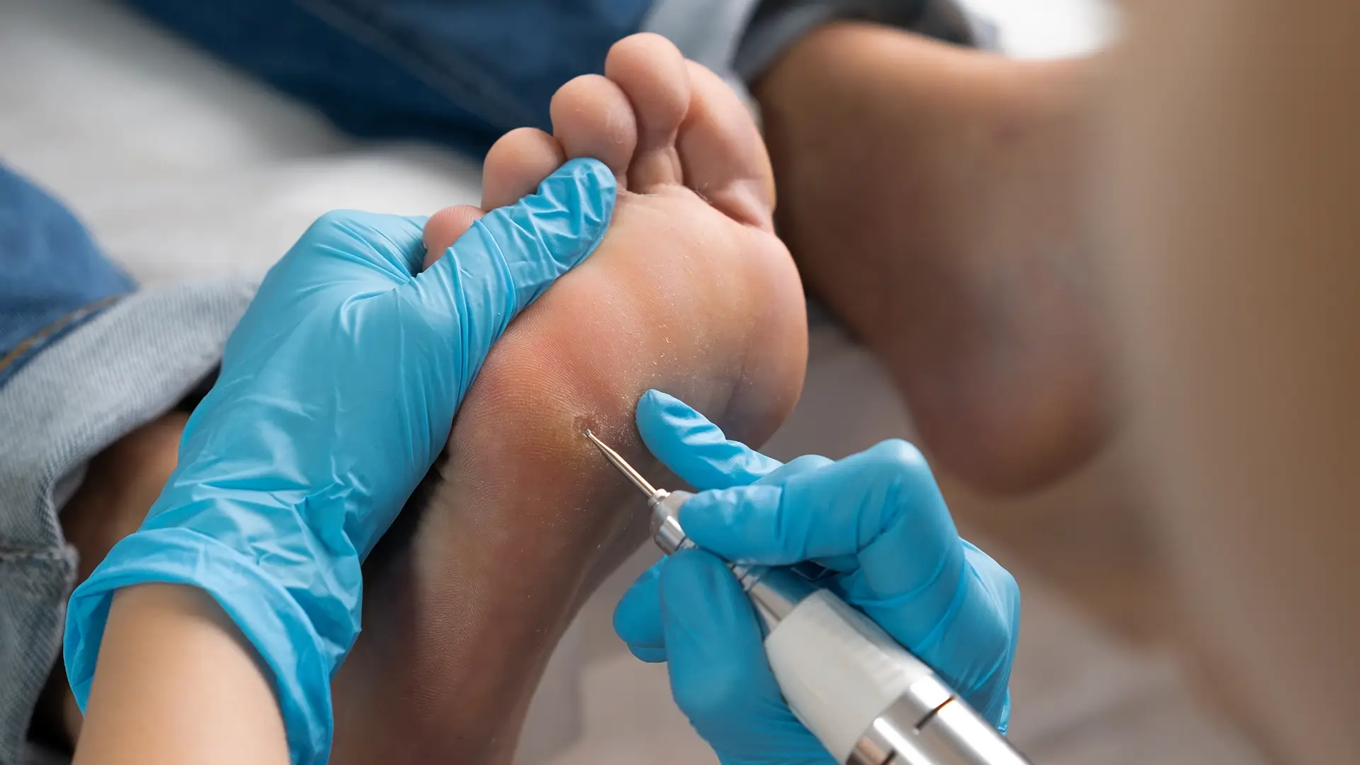 Diabetic Foot Care Billing